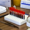 Россиян предупредили о риске рака и болезней сердца из-за нехватки витамина D