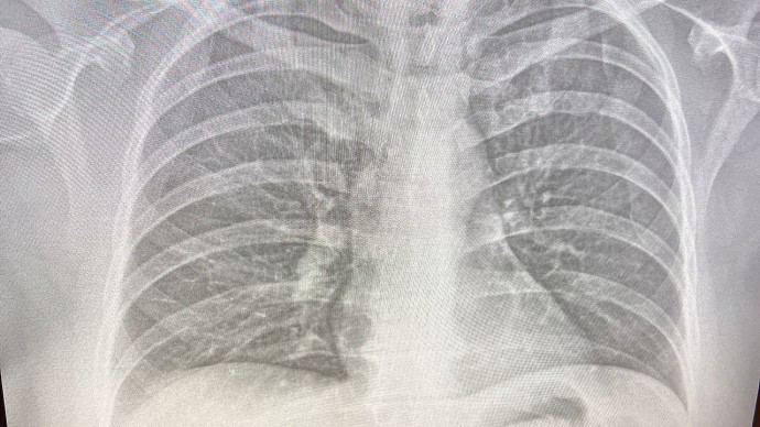 В Прилепы 23 октября приедет передвижной флюорограф В Прилепы 23 октября приедет передвижной флюорограф