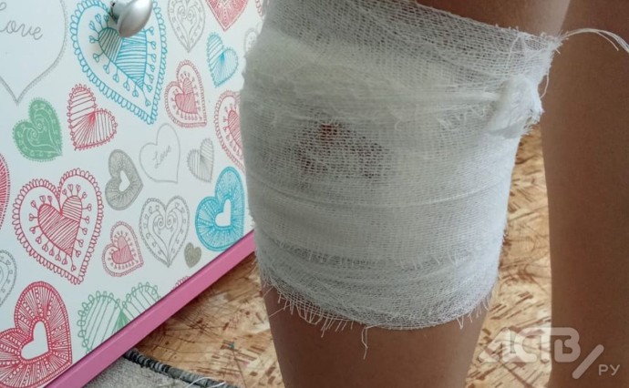 Домашняя собака напала на семилетнюю девочку в парке в Долинске Домашняя собака напала на семилетнюю девочку в парке в Долинске