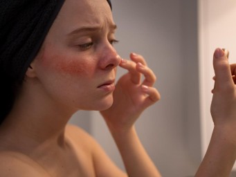 Аллергия на косметику: симптомы, которые легко спутать с обычным раздражением