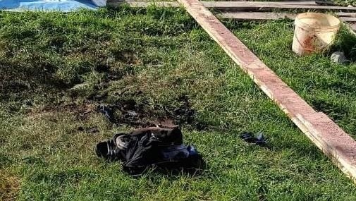 В Башкирии мужчина получил страшные ожоги при курении