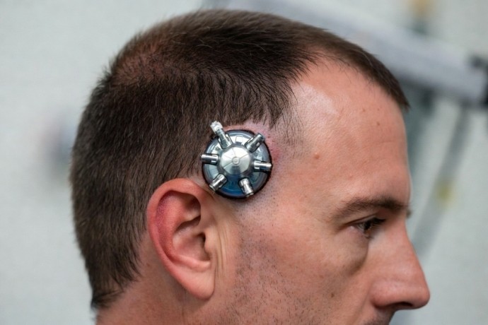 Стартовал серийный выпуск мозговых имплантов Илона Маска