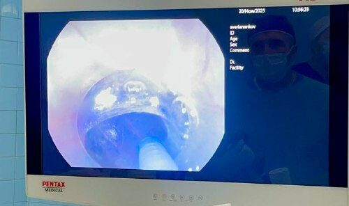 Не могла проглотить даже воду: в НИИ скорой помощи им. И.И. Джанелидзе помогли пациентке с редкой патологией пищевода Не могла проглотить даже воду: в НИИ скорой помощи им. И.И. Джанелидзе помогли пациентке с редкой патологией пищевода