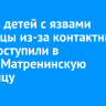 Девять детей с язвами роговицы из-за контактных линз поступили в Ивано-Матренинскую больницу