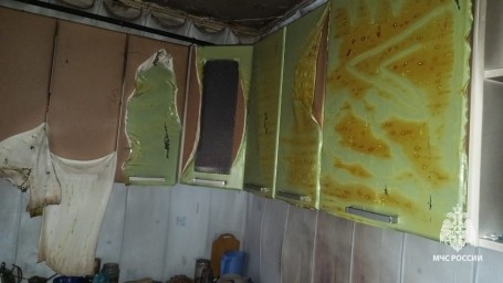 В Башкирии от ожогов погиб 43-летний мужчина