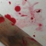Опасна для окружающих: в Астрахани женщину с туберкулёзом принудительно госпитализировали