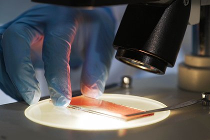 Найден способ замедлить старение и продлить жизнь Найден способ замедлить старение и продлить жизнь