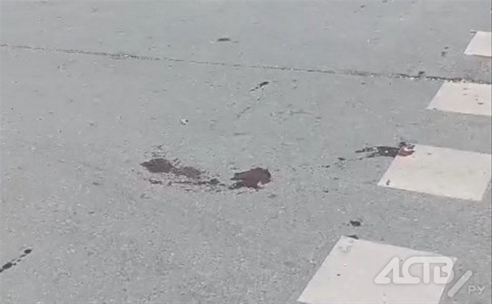 Головой об асфальт: девушка упала с самоката и потеряла сознание в Южно-Сахалинске