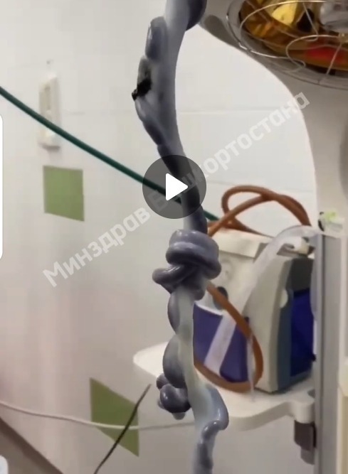 В Уфе появился на свет ребёнок с уникальной пуповиной В Уфе появился на свет ребёнок с уникальной пуповиной