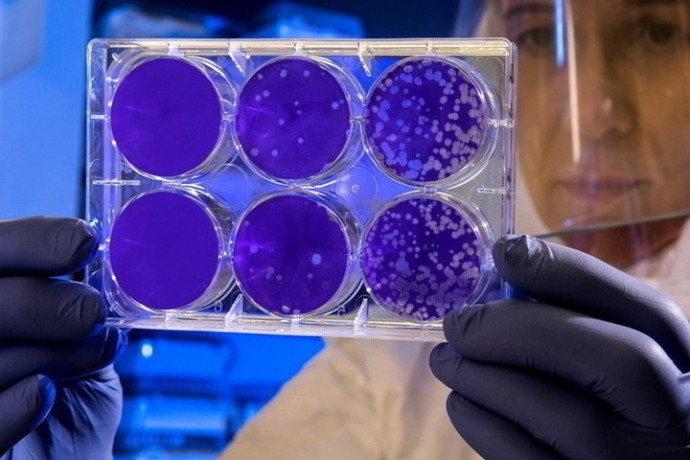 Ученые назвали первую болезнь, которая мучила людей еще миллионы лет назад