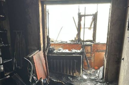 В больнице Ярославля скончалась пострадавшая во время пожара женщина