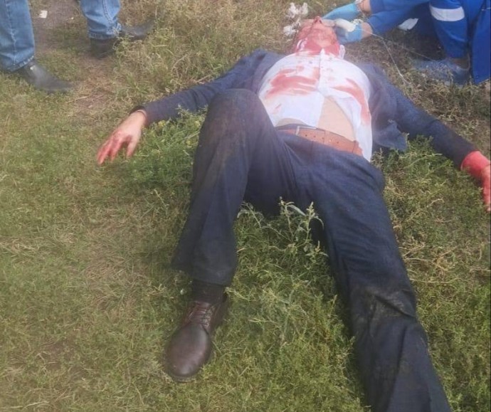 Нападение на главу Каменского района: стало известно, какие травмы получил чиновник