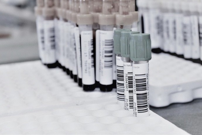 Падает или растет: Назван здоровый уровень сахара в крови для мужчин Падает или растет: Назван здоровый уровень сахара в крови для мужчин