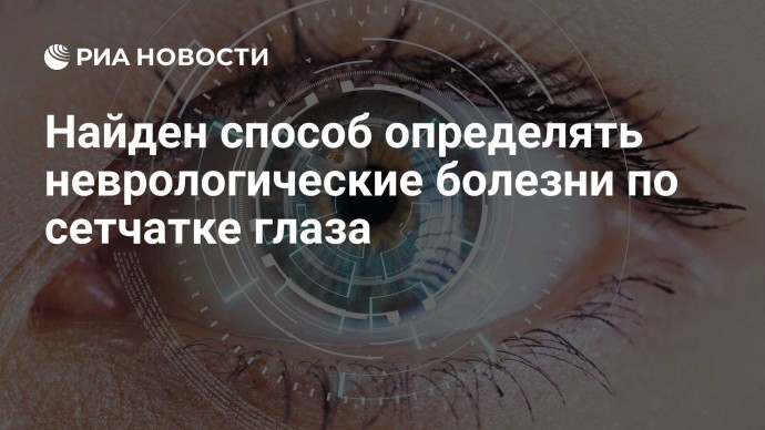 Найден способ определять неврологические болезни по сетчатке глаза