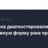 У Байдена диагностировали агрессивную форму рака простаты
