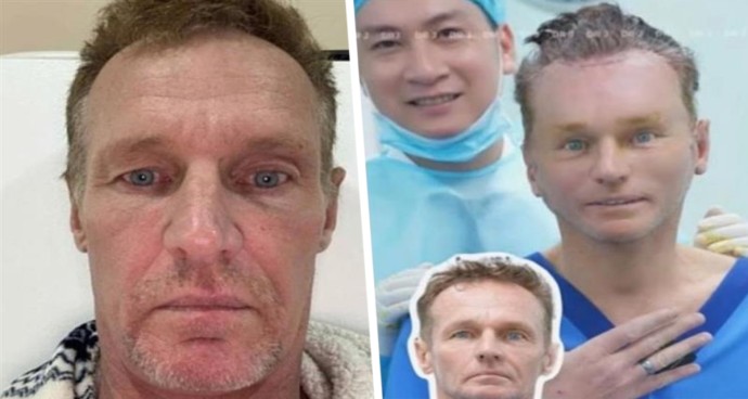 Вьетнамский переворот: турист превратился из мужика в мальчика и стал звездой TikTok после косметической операции за $4000