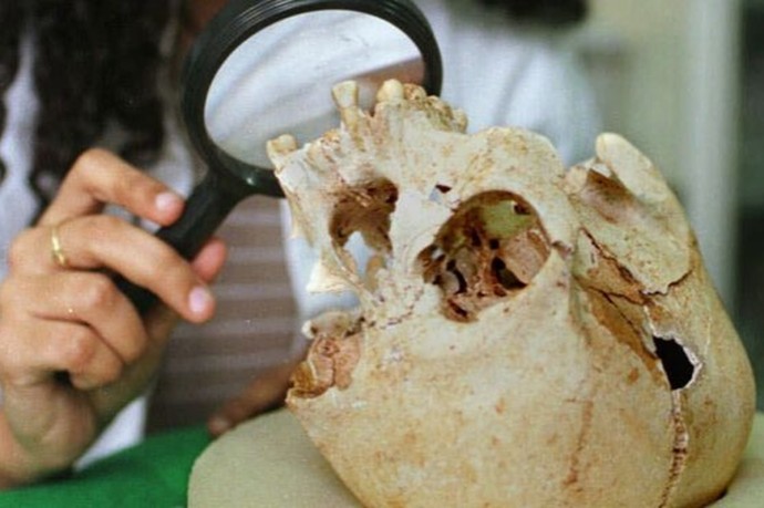 В МФТИ заявили, что нашли в зубах людей бронзового века следы пневмококка В МФТИ заявили, что нашли в зубах людей бронзового века следы пневмококка
