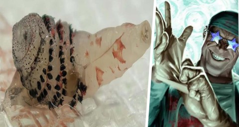 Урок для путешественников по тропикам: мухи откладывают личинки прямо под кожу туристов