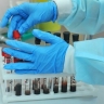 Минздрав обновит порядок обязательной проверки на ВИЧ