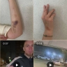 «Мой отец в МВД — мне всё сойдёт с рук»: полиция бездействует в деле об избиении и угрозах