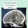 Кировские врачи спасли мальчика, проткнувшего глазницу шампуром