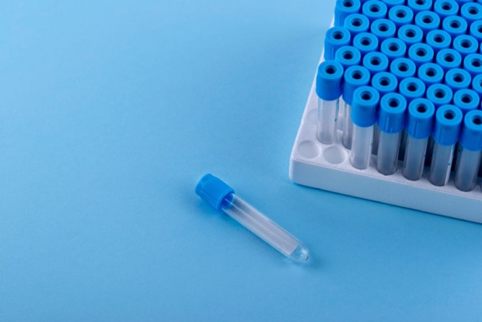 Океан тайн: приморские учёные создают «детектор ядов» для морепродуктов Океан тайн: приморские учёные создают «детектор ядов» для морепродуктов