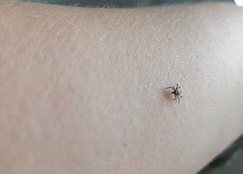 За неделю в Приамурье зарегистрировали 253 обращения по поводу укусов клещей