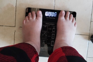 Врач Королева: таблетки для похудения не убирают первопричину ожирения