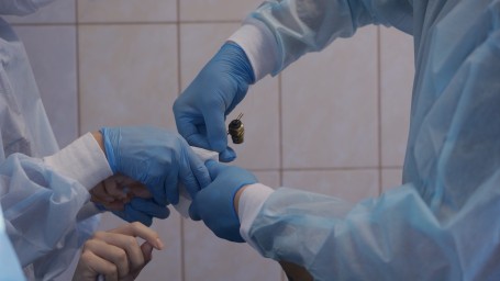 Петербургские микрохирурги провели уникальную операцию, восстановив подростку руку