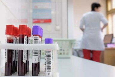 В нескольких регионах России за год заметно выросло число ВИЧ-инфицированных