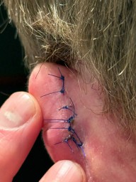 Капитан ХК «Салават Юлаев» показал свое ухо после травмы