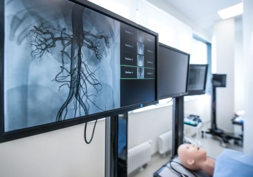 Столица первой в России пилотно внедрила мониторинг для профилактики сосудистых катастроф