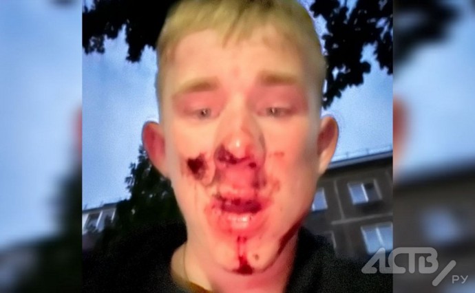“Закидывали булыжниками и угрожали порезать”: толпа избила и обокрала подростка в Южно-Сахалинске