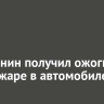 Иркутянин получил ожоги при пожаре в автомобиле