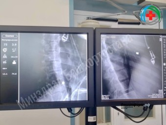 Стало известно, кто выстрелил в сердце 11-летней девочки из Башкирии