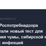 Ученые Роспотребнадзора разработали новый тест для выявления чумы, сибирской язвы и еще трех инфекций