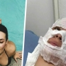 Как туристка недооценила силу солнца в Таиланде и теперь горько об этом жалеет