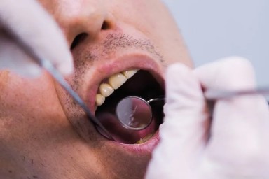 Можно ли проверить прикус с помощью искусственного интеллекта? Отвечает ортодонт