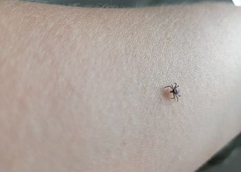 За неделю в Приамурье зарегистрировали 253 обращения по поводу укусов клещей