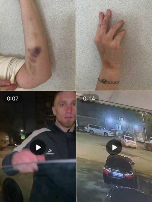 «Мой отец в МВД — мне всё сойдёт с рук»: полиция бездействует в деле об избиении и угрозах