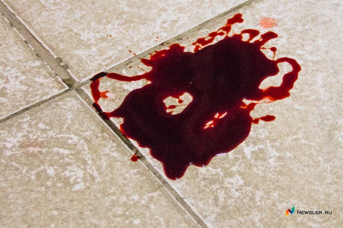 В Юрьянском районе рабочий пострадал при падении гидроманипулятора