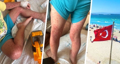 Турецкий All Inclusive обернулся кошмаром: отравления в отелях бьют даже по местным