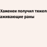 Reuters: Хаменеи получил тяжелые и обезображивающие раны