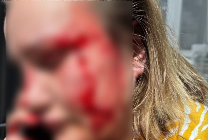 Жестоким избиением жительницы Владивостока занялась полиция