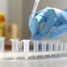 Более 1,6 млн россиян привились от клещевого энцефалита с начала года