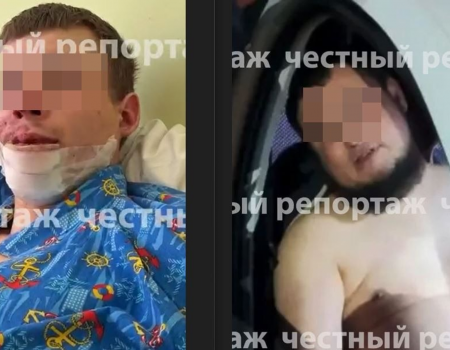 Стало известно о самочувствии уфимца, избитого неадекватным водителем