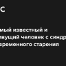 Умер самый известный и долгоживущий человек с синдромом преждевременного старения