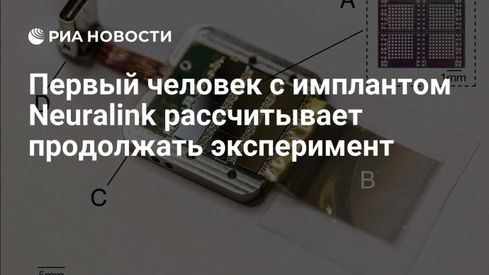 Первый человек с имплантом Neuralink рассчитывает продолжать эксперимент