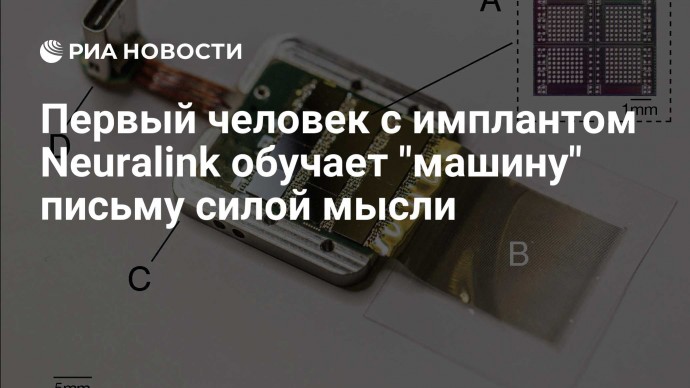 Первый человек с имплантом Neuralink обучает "машину" письму силой мысли