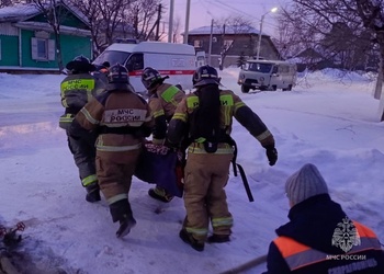 Амурчанка пострадала в пожаре в Свободном